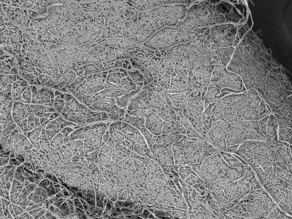 Electron microscope image of a steamed rice grain inoculated with koji after 36 hours of growth.