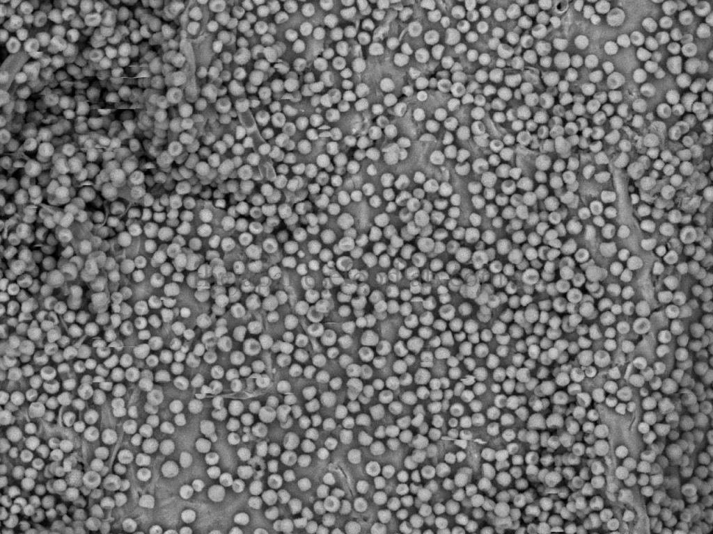 Electron microscope image of koji spores from a specialist tane maker.