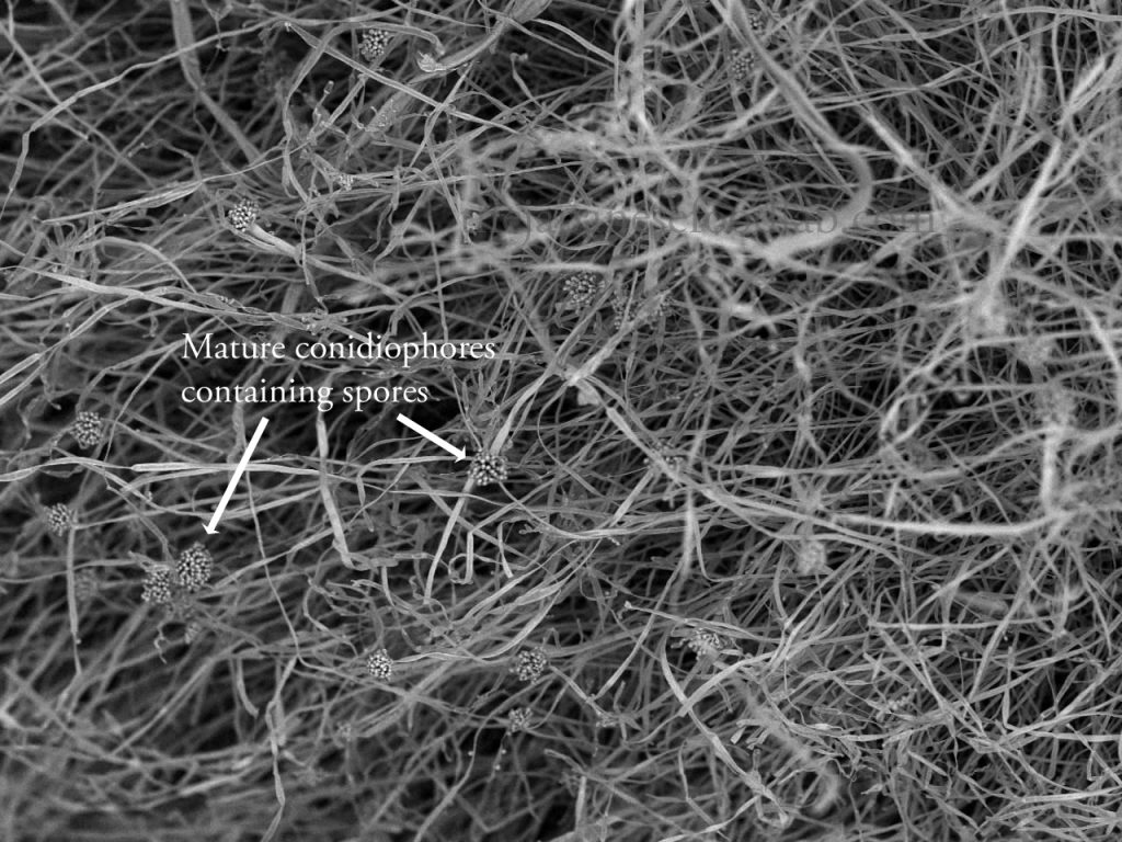 Electron microscope image of a steamed rice grain inoculated with koji showing mature conidiophores containing spores.